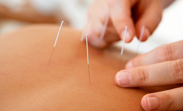 akupunktura za povečanje moči
